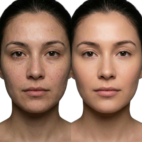 Professional Skin Treatment